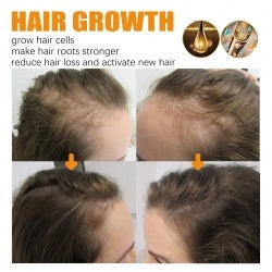 Biotin Hair Essential Oil – Growth & Strength Formula
