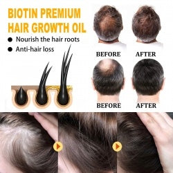 Biotin Hair Essential Oil – Growth & Strength Formula